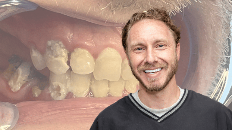 Stubbs Dental Patient Reviews Dental Implants